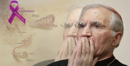 alzheimer
